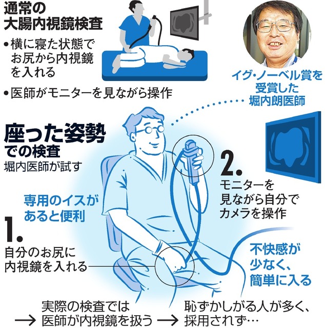 日本医生尝试坐著进行肠镜检查 获搞笑诺贝尔