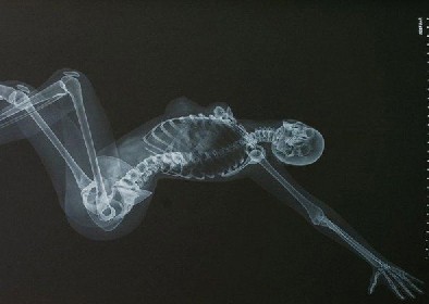 日本推出X光版骨感美女日历